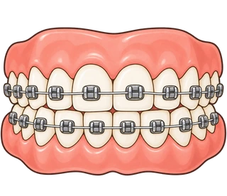aparelho dentário