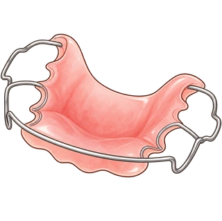 contenção dentária